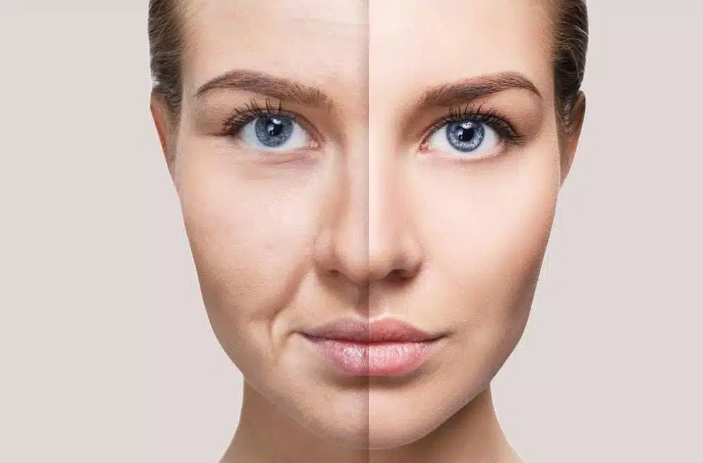 Skincare antes e depois