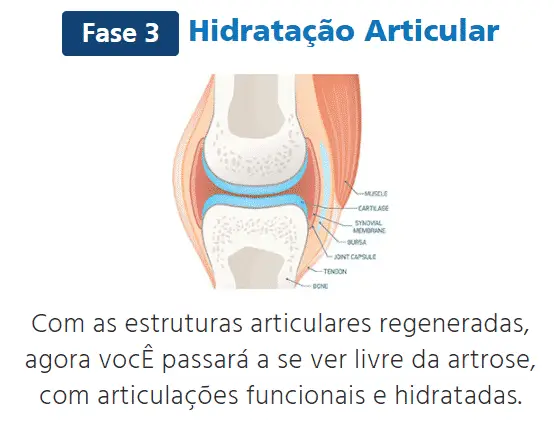 Artrofim hidratação articular